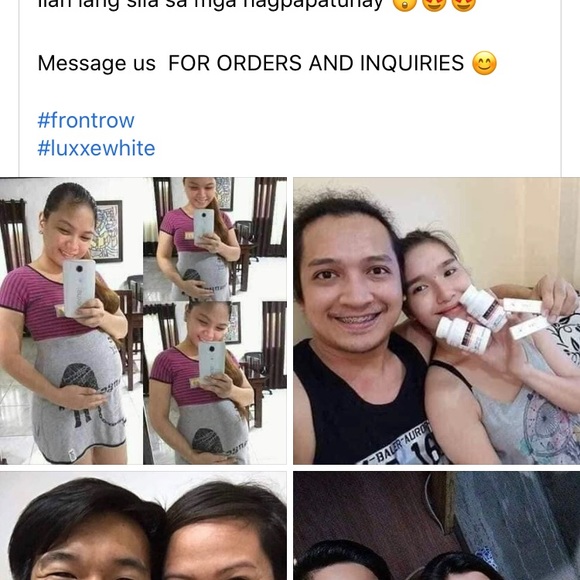 Frontrow Luxxe - Picture 5 of 10